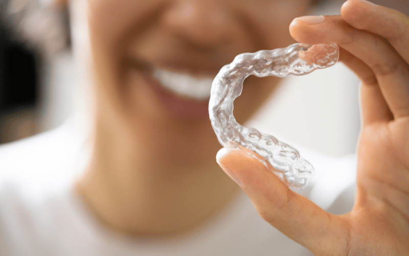 clear aligners