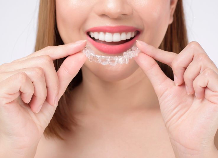 Invisalign