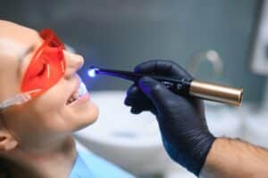 Teeth Whitening in Montague