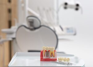 Dental Implants in Whitehall